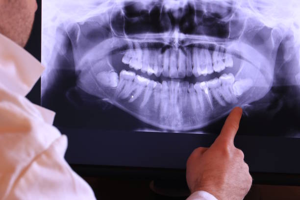 Best Emergency Treatment for Jaw Pain or Injury in Energy, IL